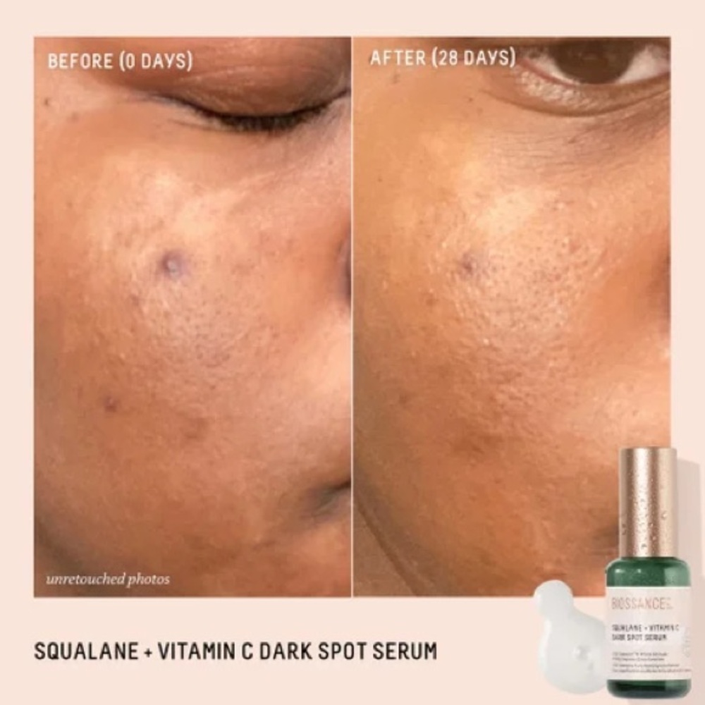 BIOSSANCE Squalane + Vitamin C Dark Spot Serum NIB 30 ml - Picture 3 of 6
